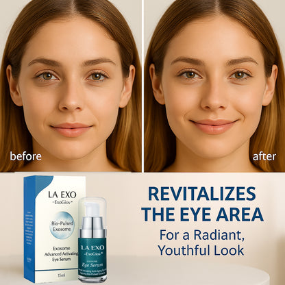 Exosome Eye Serum – Advanced Anti-Aging Treatment for Puffiness, Dark Circles & Fine Lines – Brightening & Smoothing Undereye Skin Care, 15ml
